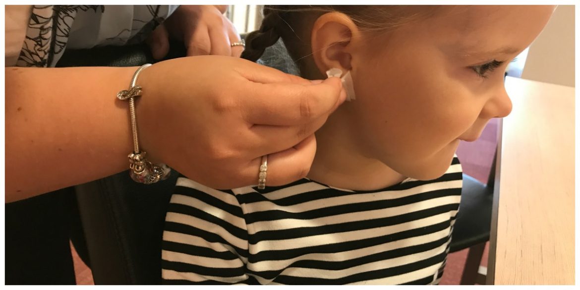 Gaatjes schieten bij kinderen, waar moet je op letten en hoe gaat dat?